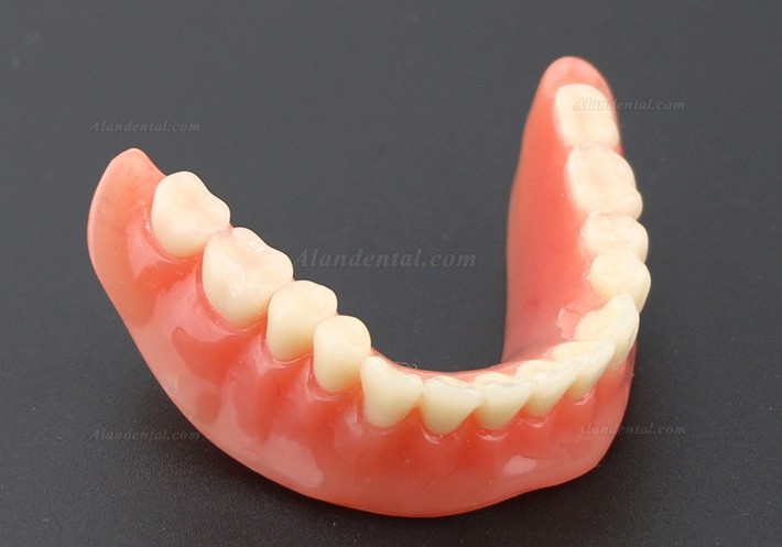 Dental Teeth Model Overdenture Inferior with 2 Implants Study Demo Model 6002 01